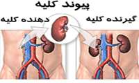 70 درصد بیماران دیالیزی استان در انتظار پیوند کلیه
